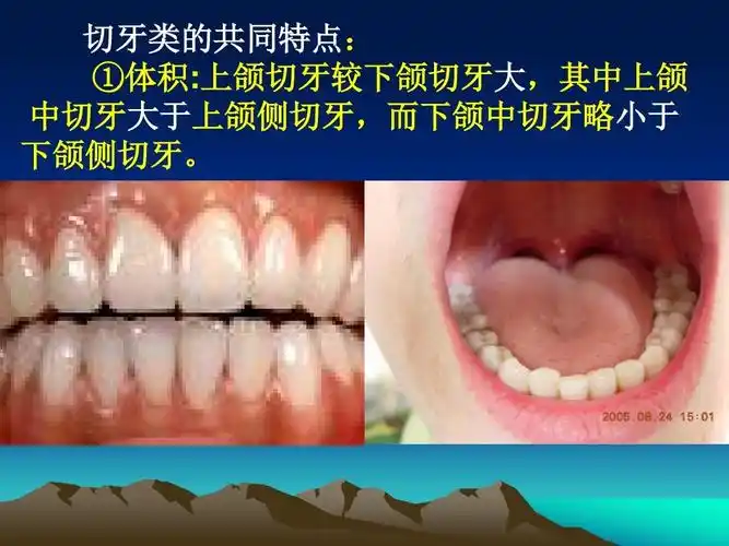 口腔切牙解剖形态ppt