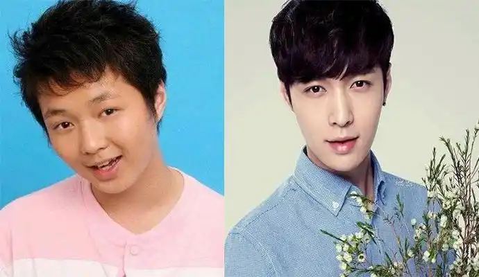 传张艺兴整容前后