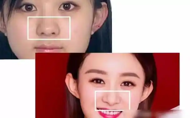 赵丽颖出道12年从土里土气变成时髦精致整得太明显了