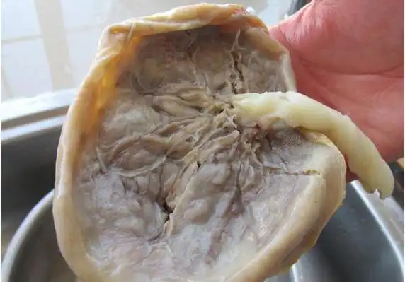 吃胎盘有好有坏请君慎重