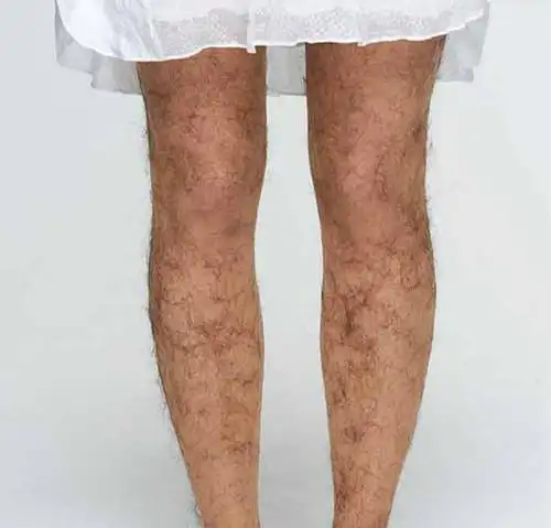 我是女生,小腿腿毛很多有没有什么办法?