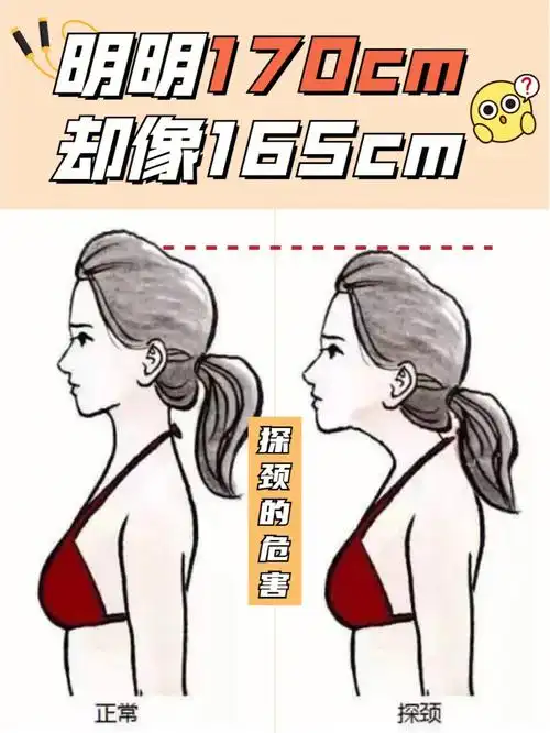 前倾不仅会带来短脖子还改变了身体重心身体为了找平衡只能把骨盆顶