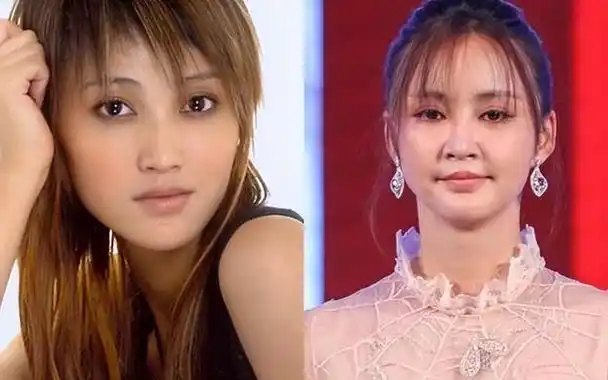 刚出道的沈梦辰长相很土气,原生脸颧弓外扩,面中脂肪厚重,咬肌大,下巴