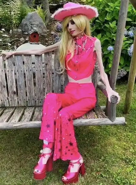 国外厌食症美女走红:瘦到皮包骨也要扮芭比