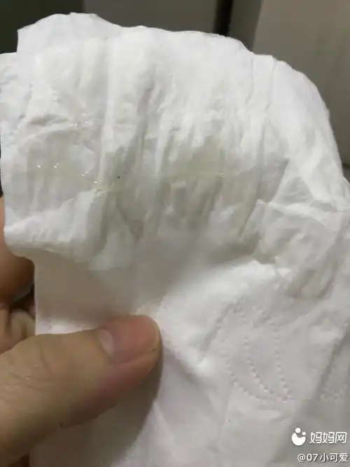 姐妹们这是排卵了吗出现白带拉丝