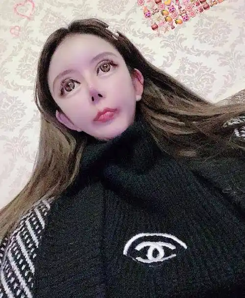 原创那个13岁开始整容花300万整100次的女孩如今走上人生巅峰了吗