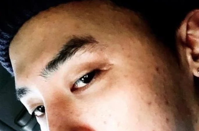 原创同样都是卸妆,权志龙lisa都还行,可看到她:用不用都一样!