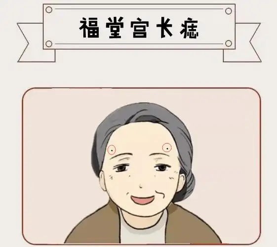 算命先生提醒身体6颗巨富痣藏而不漏只要有一颗辈辈发家代代富