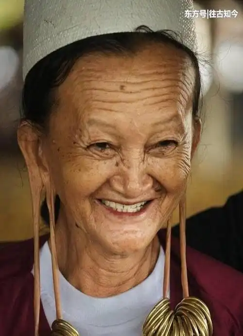 耳朵巨痛真不会断了吗?慎入,一定要慎入