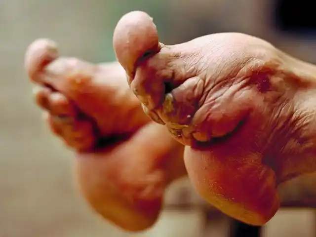 古人为什么最爱"三寸金莲"