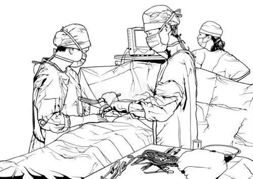 手术中简笔画