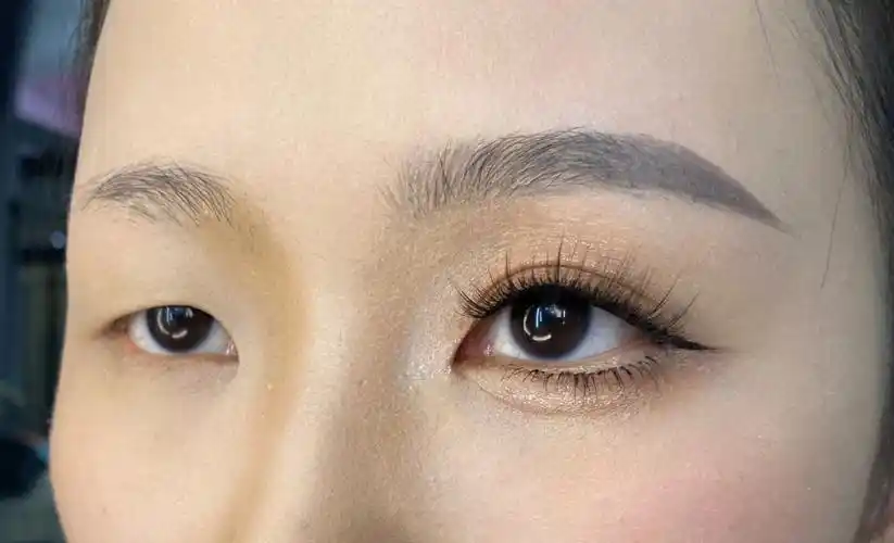 眼尾下垂单眼皮无肌力敏感眼睛