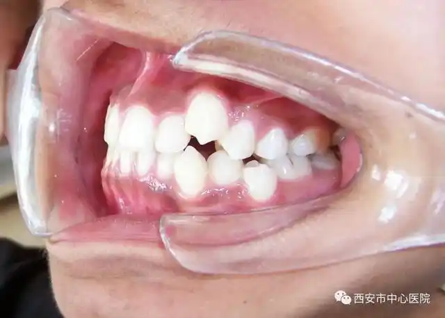 科普知识虎年话虎牙