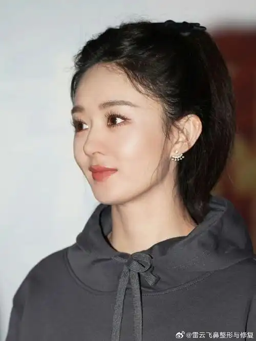 赵丽颖##武汉隆鼻##今日美貌营业