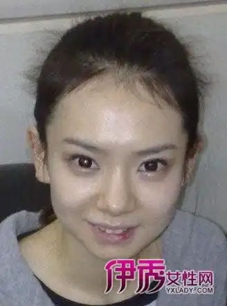 美女明星戚薇整容前后照片曝光