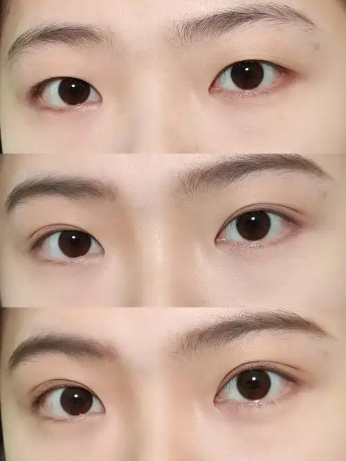 单眼皮姐妹们你们要的双眼皮贴教程来了