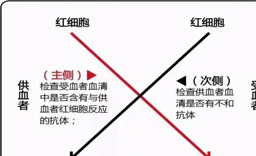 并且根据凝集反应原理,将供血者和受血者的血液做交叉配血实验,在体外