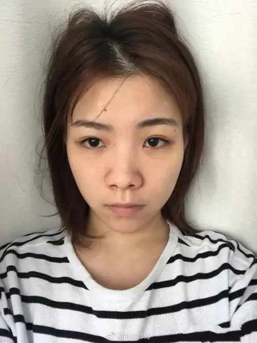 我鼻子特别特别扁的哪种,鼻翼还很肥厚