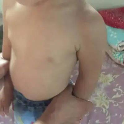 两岁两个月站立时乳房感觉有点大怎麼办