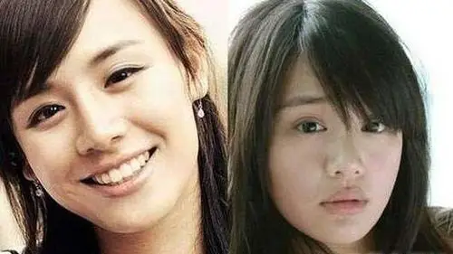 马思纯整容黑历史也被扒