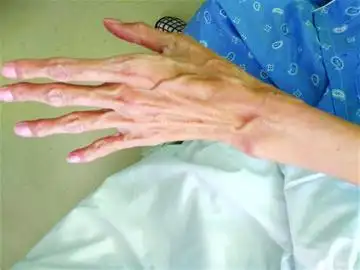 血压蹦高,"蜘蛛人"没了"劲"