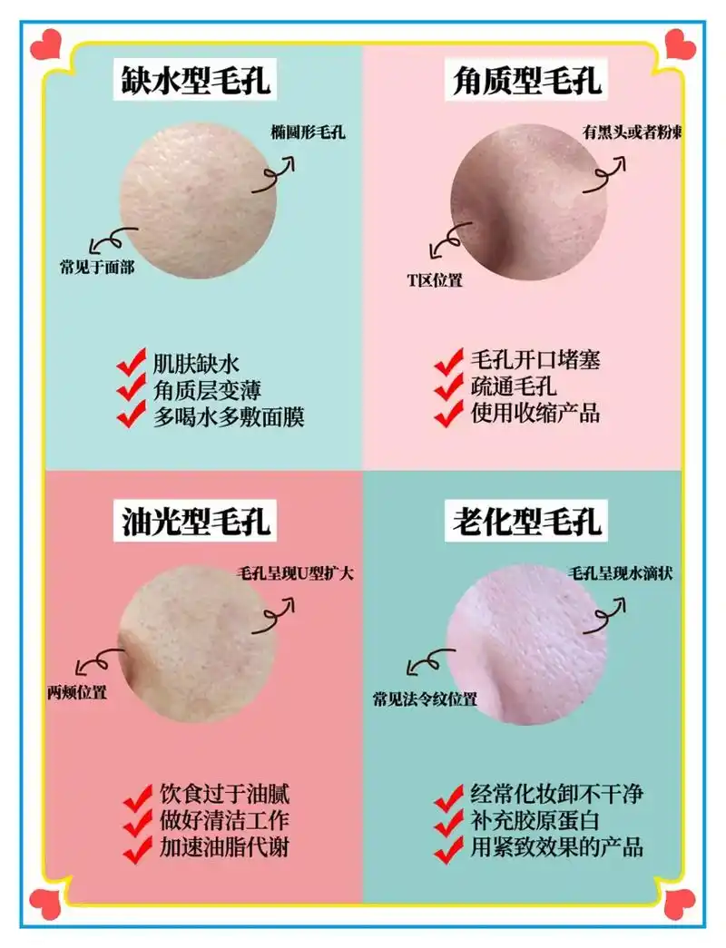 毛孔四大类型,看看你是哪一种,针对性改善#护肤干货 #皮肤  - 抖音