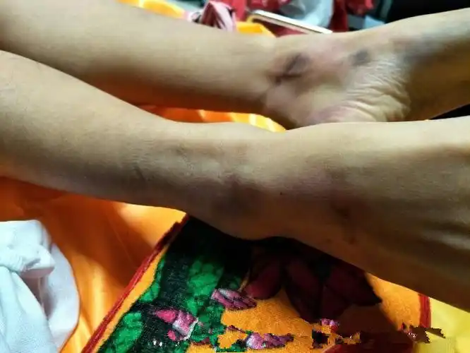 济南一女大学生校内裸体坠亡警方认定排除他杀