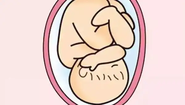 胎位loa左侧睡真的不会压到胎儿吗