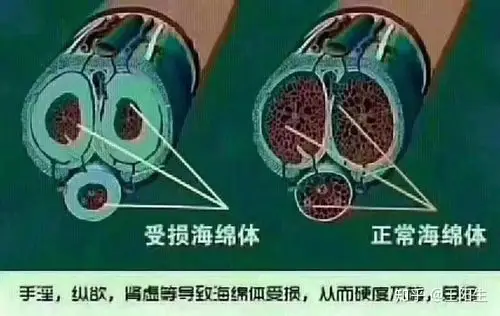 男人海绵体损伤,究竟有多么可怕? - 知乎