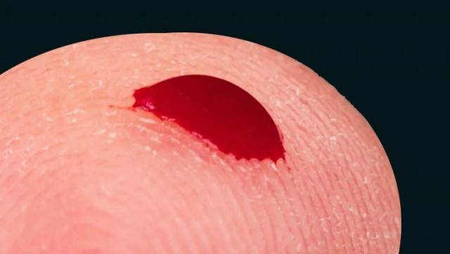 一滴血 诊断癌症