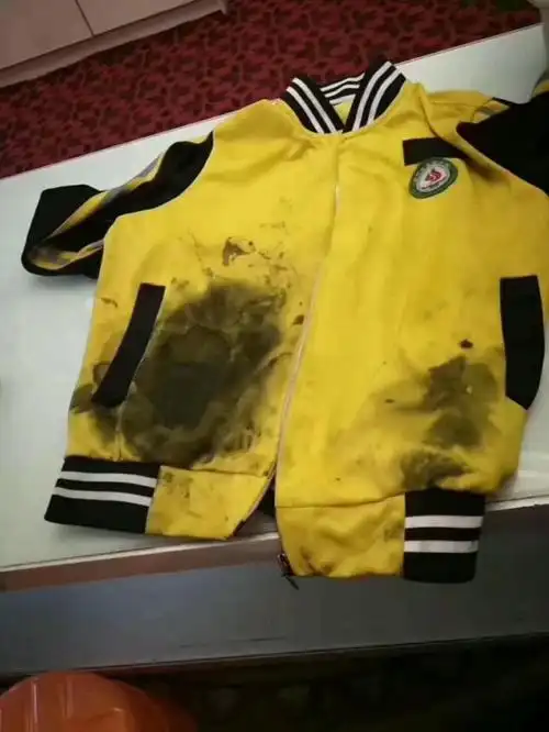 孩子校服不明污渍用潮牛就对了