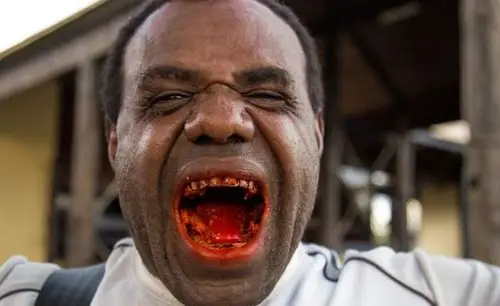 这里的口腔癌症全球最多因一种植物全家人嘴里染得通红