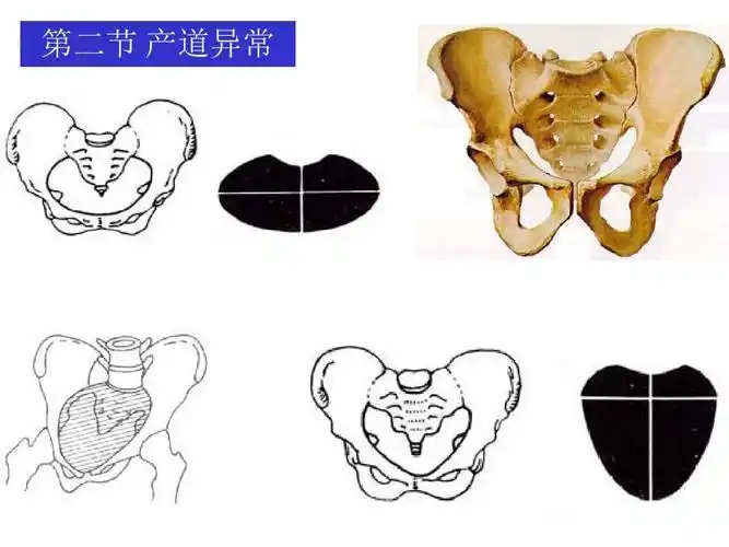 第二节 产道异常