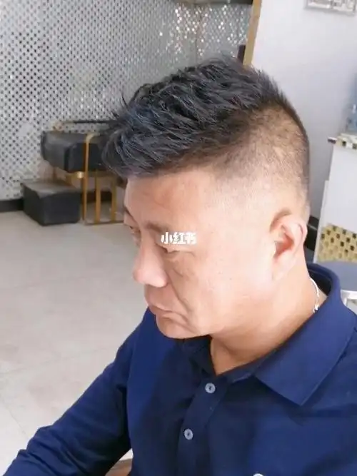 男生什么样的发型好看_香香美发手机版男士头顶稀疏一定