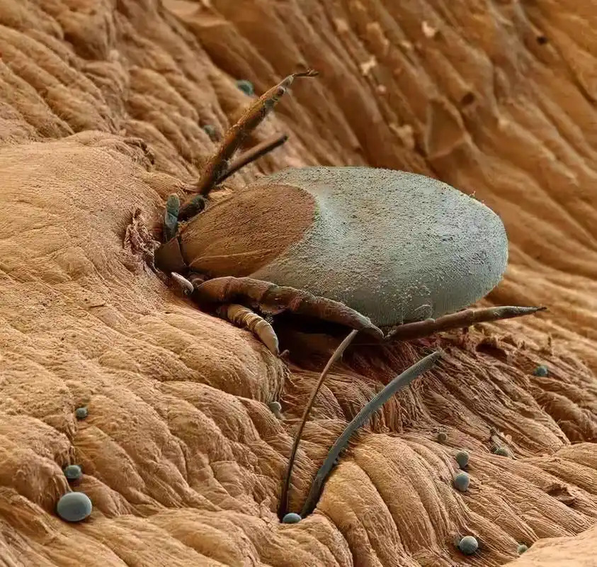 春夏螨虫滋生光靠晒被子已经不行了教你几招除螨又卫生