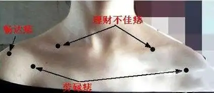 肩膀上有痣代表什么寓意