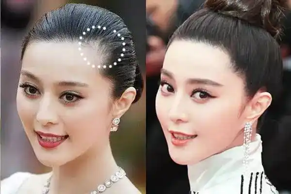 发际线这个问题可以是多少女明星的硬伤附赠防脱发小tips