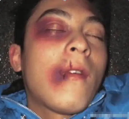 娱乐圈被殴打过的明星, 陈晓被扇45个耳光, 张艺谋被打骨折