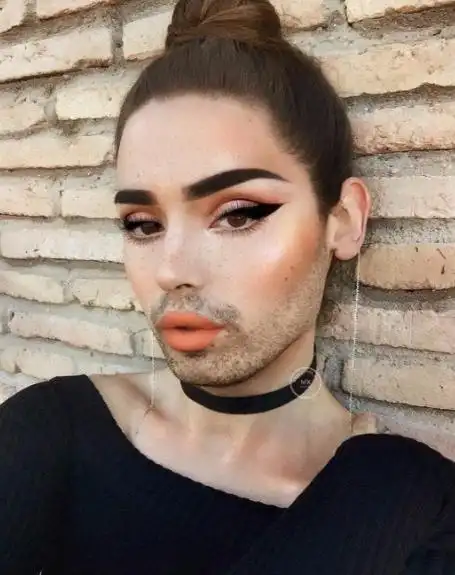 女性长胡须是什么体验提醒这3种情况或会导致女人长出胡子