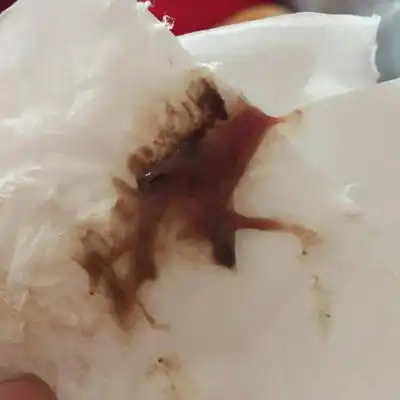 怀孕29周,昨天同房,阴道出血,早上有一块褐色东西排出来,严重吗,是怎