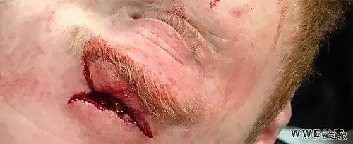 慎入希莫斯本周raw比赛不慎爆头