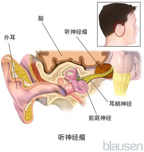 search results for: 副神经节瘤 - 《默沙东诊疗手册家庭版》