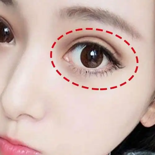 什么季节做双眼皮修复最好(双眼皮类型有哪些图片大全)_捷讯网