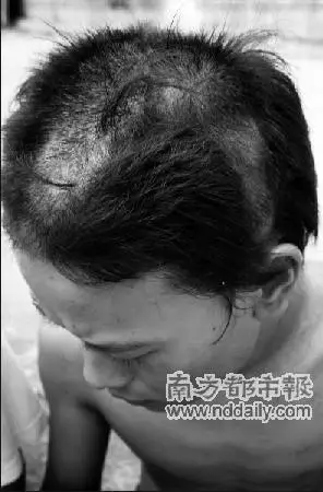 晓硫茂密的头发被剪成了阴阳头.