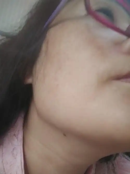 下巴底下有颗痣是什么意思