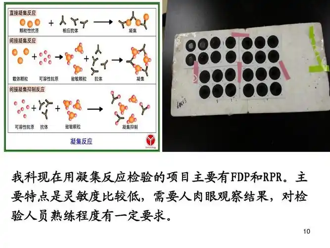 学检验与临床-刘斌ppt 我科现在用凝集反应检验的项目主要有fdp和rpr