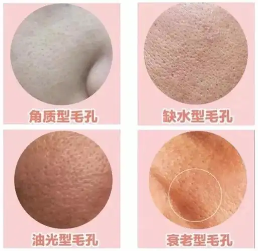 毛孔粗大不可逆?这款平价百元精华,30天见证奇迹!