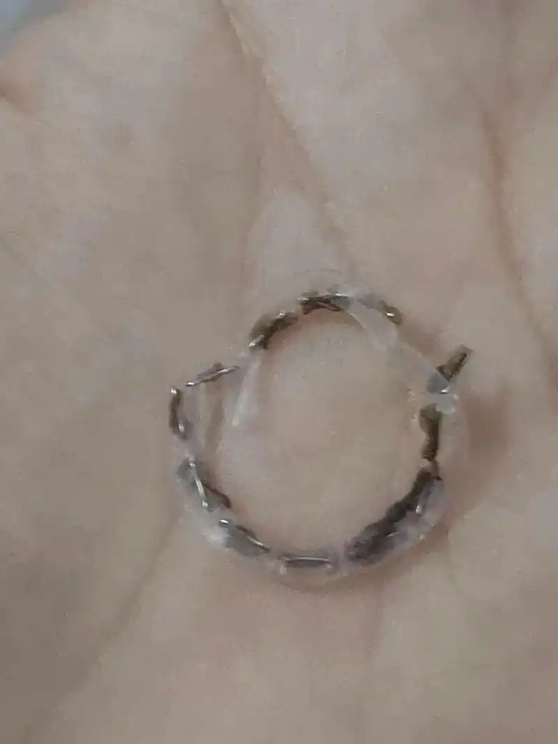 是呀 只不过是几个小钉子而已,没想到能掉这么早,没有自动脱落 - 抖音