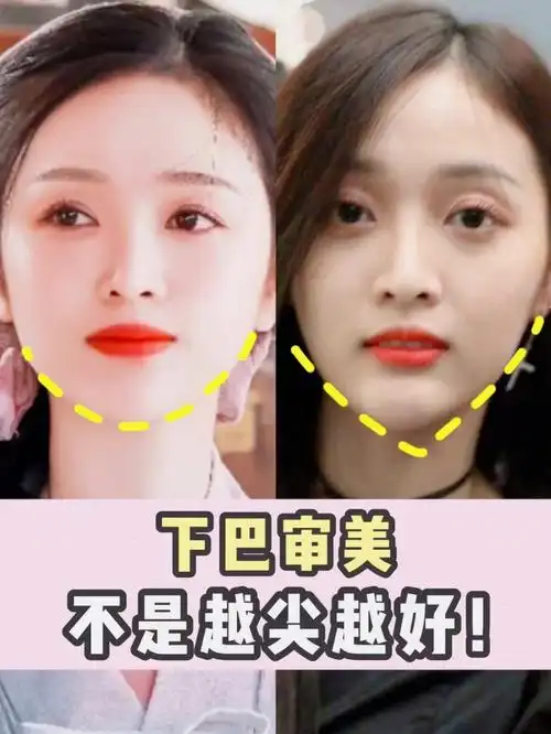 下巴不是越尖越好