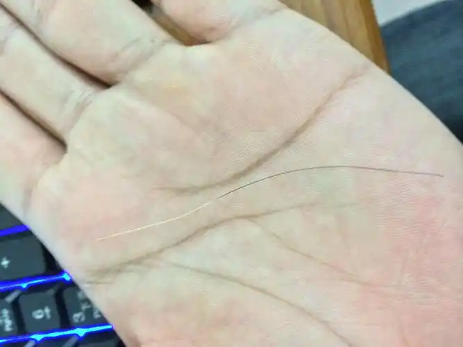 白头发 发根还是黑的